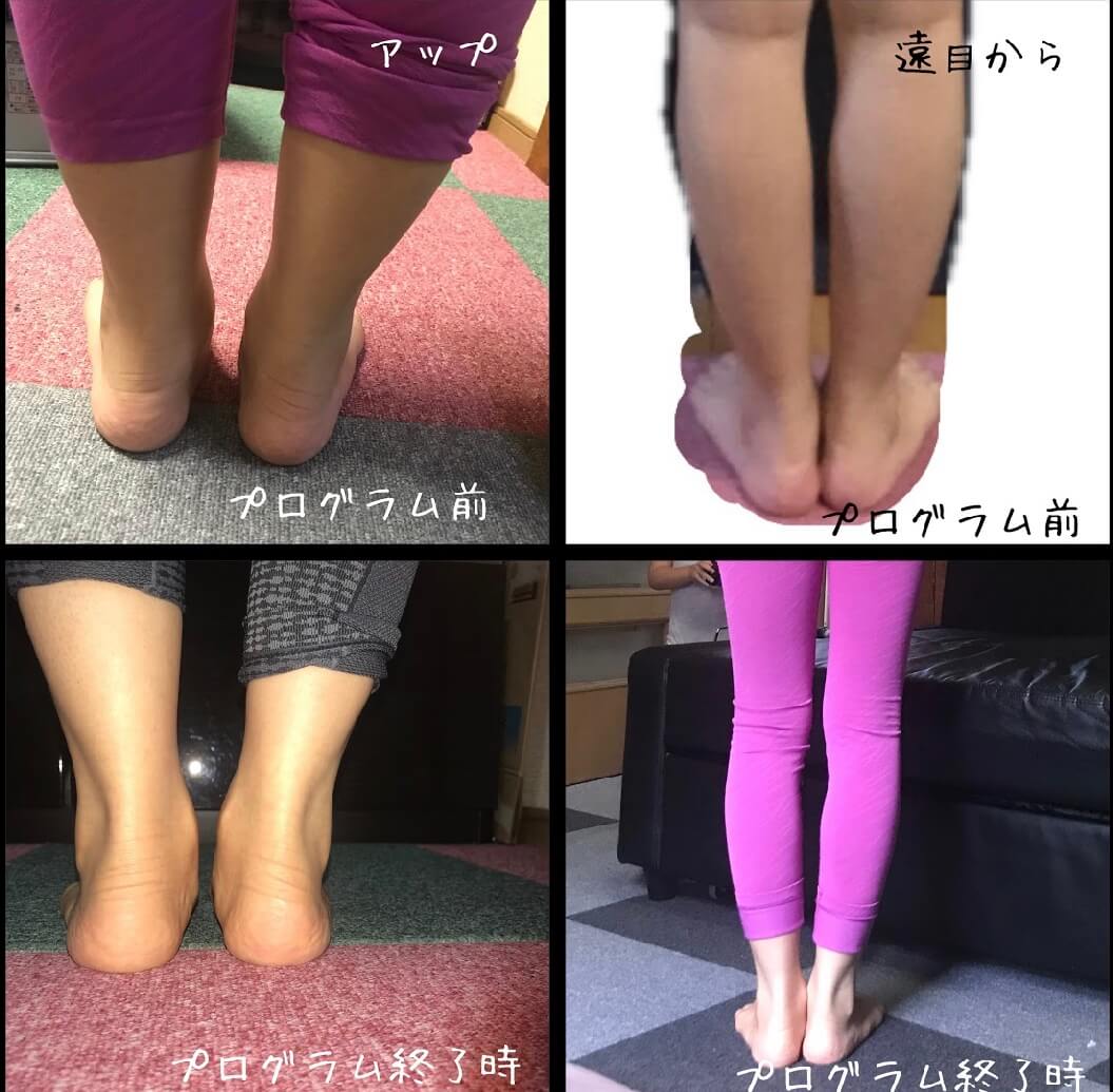 足首 が ない 女